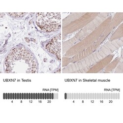 UBXN7 Antibody, Novus Biologicals:Antibodies:Primary Antibodies